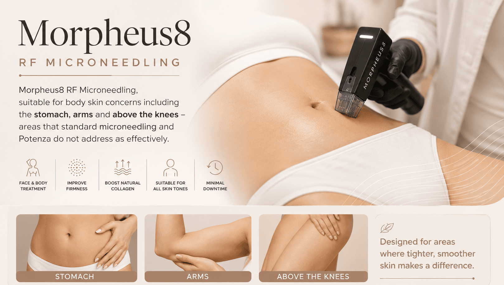 Morpheus8 at Babyskin Aesthetic Clinic, Adelaide
