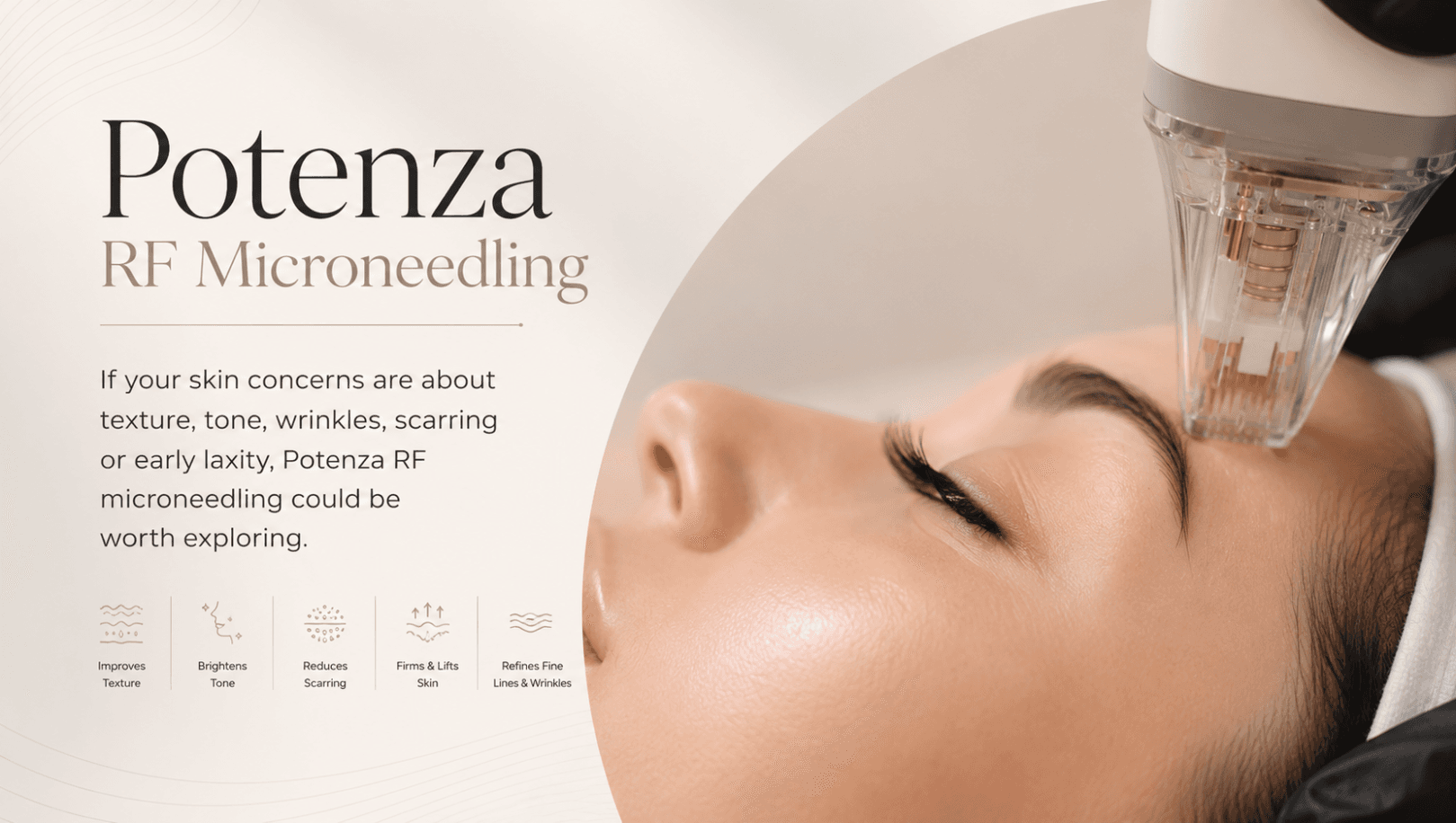 Potenza RF Microneedling